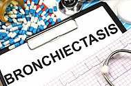 bronchiectasis