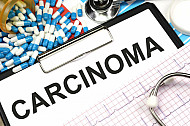 carcinoma