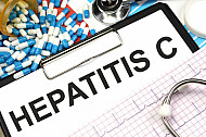 hepatitis c