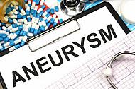 aneurysm