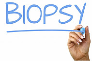 biopsy
