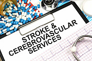 stroke and cerebrovascular services