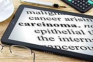 carcinoma