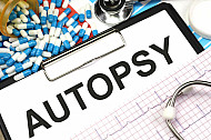 autopsy