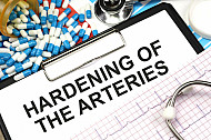 hardening of the arteries