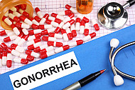 gonorrhea