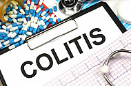colitis