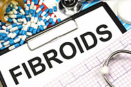 fibroids