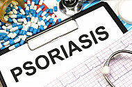 psoriasis