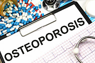 osteoporosis