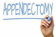 appendectomy