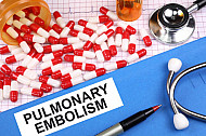 pulmonary embolism