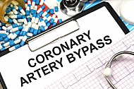 coronary artery bypass