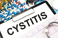 cystitis