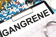 gangrene