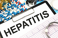 hepatitis